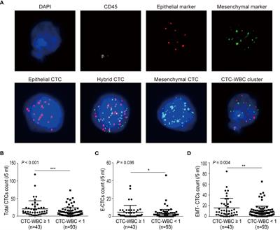 Circulating tumor cell associated white blood cell cluster as a biomarker for metastasis and recurrence in hepatocellular carcinoma